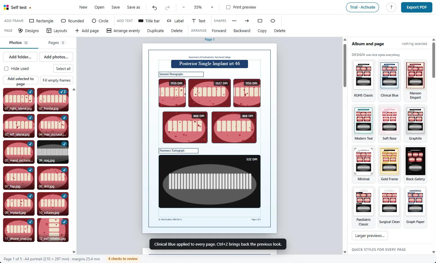 The same case page after the Clinical Blue design: navy title bar, blue page border and a light blue background